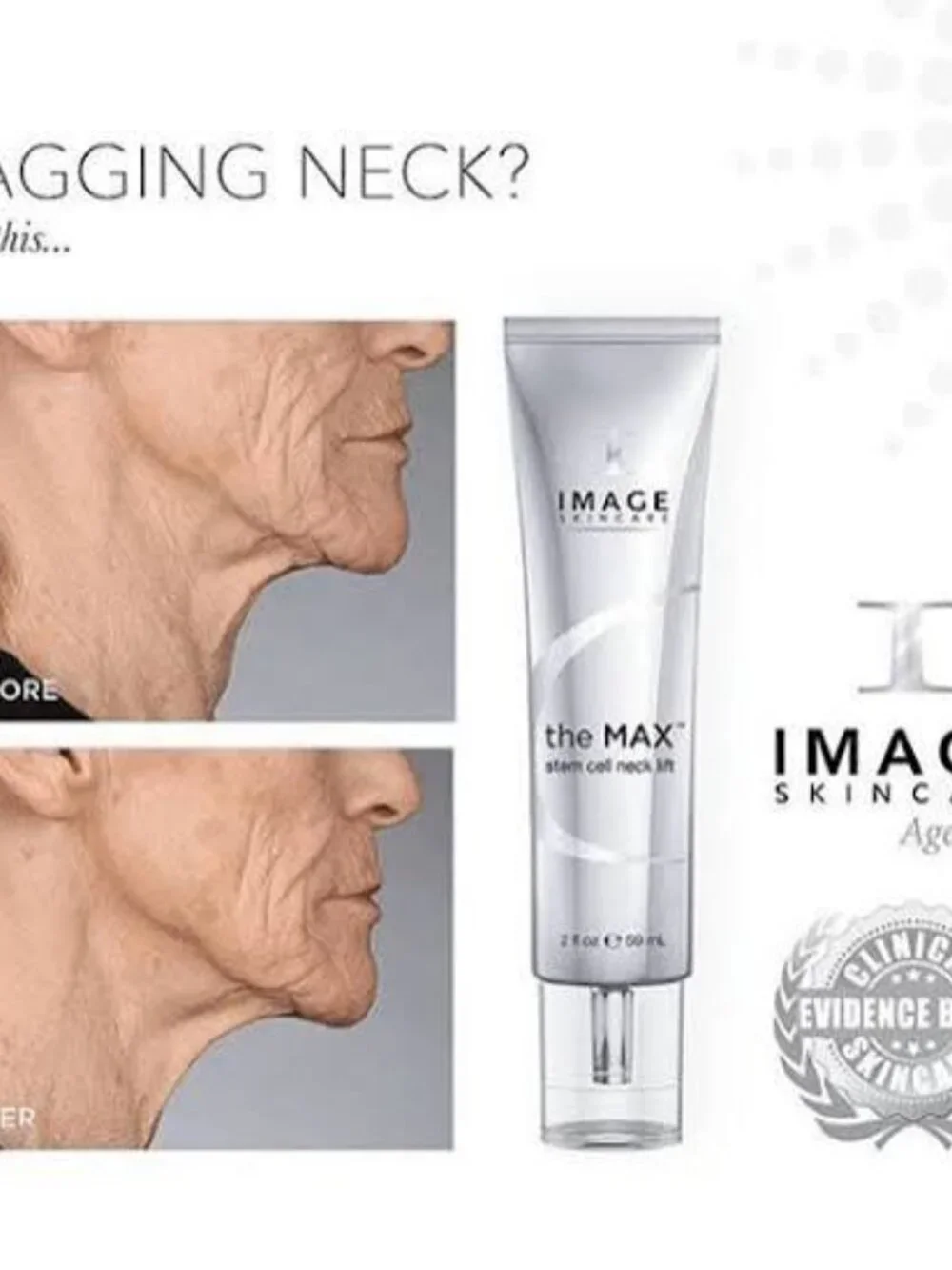 Image Skincare winner dermascope